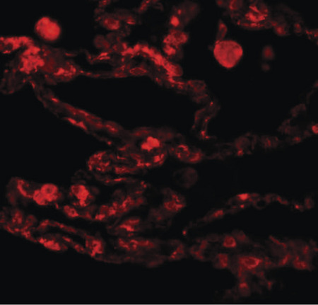 Immunofluorescence of CCDC69 in human lung tissue with CCDC69 antibody at 20 ug/ml.