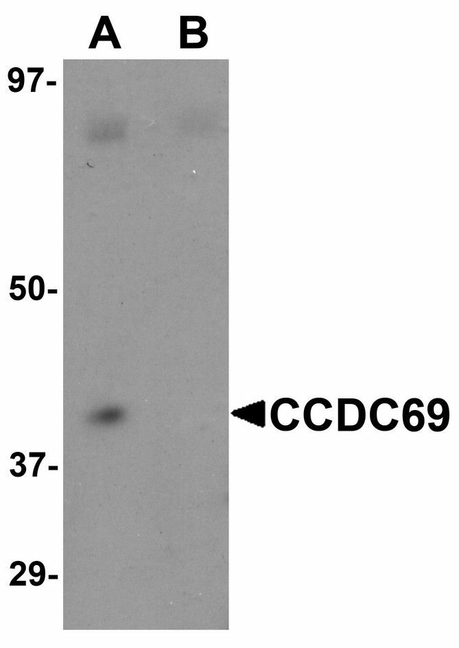 Western blot of CCDC69 in mouse lung tissue lysate with CCDC69 antibody at 1 ug/ml in (A) the absence and (B) the presence of blocking peptide.