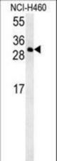 CCDC69 Antibody western blot of NCI-H460 cell line lysates (35 ug/lane). The CCDC69 antibody detected the CCDC69 protein (arrow).