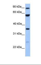 Jurkat cell lysate. Antibody concentration: 1.0 ug/ml. Gel concentration: 12%.