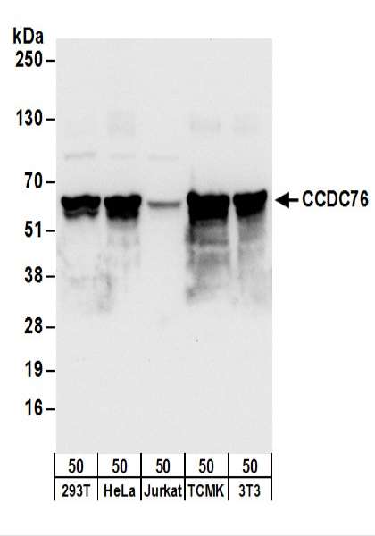Detection of Human and Mouse CCDC76 by Western Blot. Samples: Whole cell lysate (50 ug) from 293T, HeLa, Jurkat, mouse TCMK-1, and mouse NIH3T3 cells. Antibodies: Affinity purified rabbit anti-CCDC76 antibody used for WB at 0.1 ug/ml. Detection: Chemiluminescence with an exposure time of 3 seconds.
