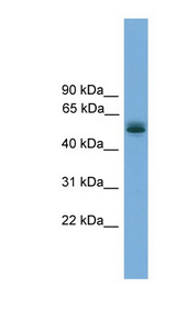 CCDC76 antibody LS-C116672 Western blot of Fetal Lung lysate.