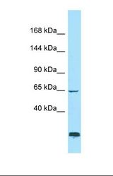 Western blot of RPMI-8226. ADAMTSL1 antibody dilution 1.0 ug/ml.