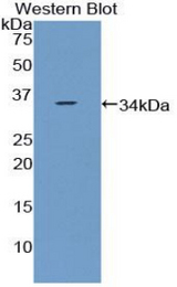 Western blot of recombinant CCDC80.