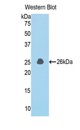 Western blot of recombinant CCDC80.