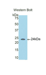 Western blot of recombinant CCDC80.