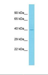 Western blot of Human Fetal Brain. CCDC81 antibody dilution 1.0 ug/ml.
