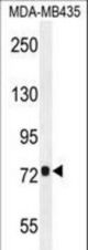 CCDC81 Antibody western blot of MDA-MB435 cell line lysates (35 ug/lane). The CCDC81 antibody detected the CCDC81 protein (arrow).