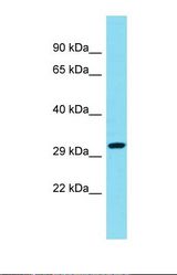 Western blot of Human ACHN. CCDC82 antibody dilution 1.0 ug/ml.