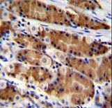 CCDC84 Antibody immunohistochemistry of formalin-fixed and paraffin-embedded human stomach tissue followed by peroxidase-conjugated secondary antibody and DAB staining.
