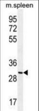 CCDC84 Antibody western blot of mouse spleen tissue lysates (35 ug/lane). The CCDC84 antibody detected the CCDC84 protein (arrow).
