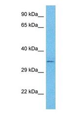 Western blot of CCD84 Antibody with human NCI-H226 Whole Cell lysate.