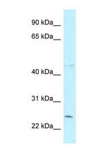 CCDC85B antibody LS-C145942 Western blot of COL0205 Cell lysate. Antibody concentration 1 ug/ml.