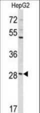 Western blot of DIPA Antibody in HepG2 cell line lysates (35 ug/lane). DIPA (arrow) was detected using the purified antibody.