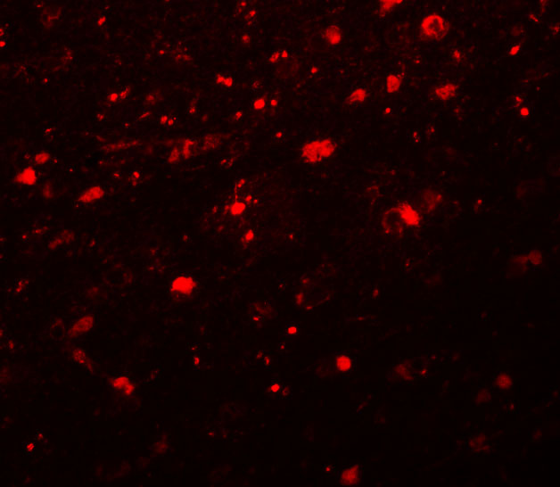 Immunofluorescence of Girdin in cells with Girdin antibody at 20 ug/ml.