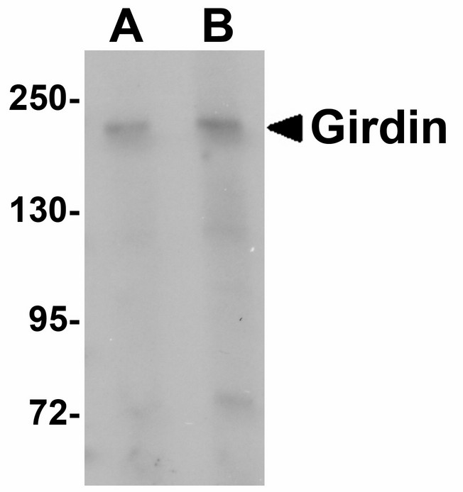 Western blot of Girdin in rat brain tissue lysate with Girdin antibody at (A) 1 and (B) 2 ug/ml.