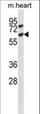 Mouse Acvr1c Antibody western blot of mouse heart tissue lysates (35 ug/lane). The Acvr1c antibody detected the Acvr1c protein (arrow).