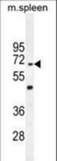 CCDC9 Antibody western blot of mouse spleen tissue lysates (35 ug/lane). The CCDC9 antibody detected the CCDC9 protein (arrow).
