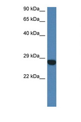 CCDC90B antibody LS-C145278 Western blot of Mouse Heart lysate. Antibody concentration 1 ug/ml.