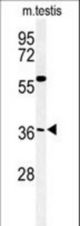 Western blot of CCD92 Antibody in mouse testis tissue lysates (35 ug/lane). CCD92 (arrow) was detected using the purified antibody.
