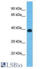 CCDC92 antibody Western Blot of HepG2. Antibody dilution: 1 ug/ml.
