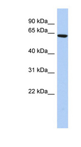 CCDC96 antibody LS-C102672 Western blot of HepG2 cell lysate.