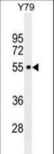 CCDC97 Antibody western blot of Y79 cell line lysates (35 ug/lane). The CCDC97 antibody detected the CCDC97 protein (arrow).