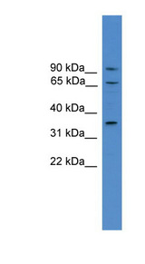 CCIN / Calicin antibody LS-C116871 Western blot of HT1080 cell lysate.