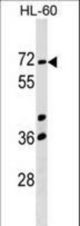 CCIN Antibody western blot of HL-60 cell line lysates (35 ug/lane). The CCIN antibody detected the CCIN protein (arrow).