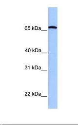 Fetal liver lysate. Antibody concentration: 1.0 ug/ml. Gel concentration: 12%.