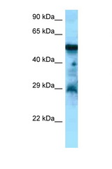 CCKBR antibody LS-C146467 Western blot of Placenta lysate. Antibody concentration 1 ug/ml.