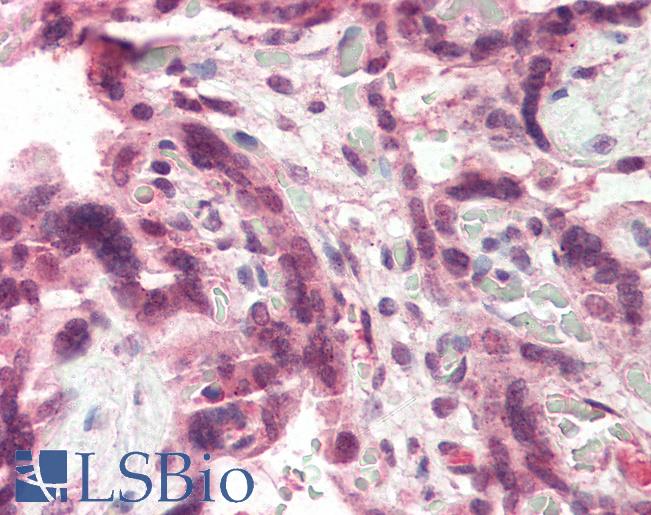 Anti-CCKBR antibody IHC of human placenta. Immunohistochemistry of formalin-fixed, paraffin-embedded tissue after heat-induced antigen retrieval. Antibody LS-B2325 concentration 5 ug/ml.