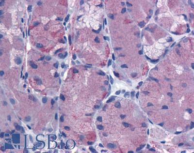 Anti-CCKBR antibody LS-A6535 IHC of human stomach. Immunohistochemistry of formalin-fixed, paraffin-embedded tissue after heat-induced antigen retrieval.