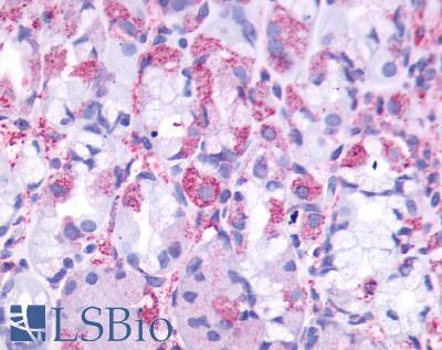 Anti-CCKBR antibody LS-A1282 IHC of human stomach. Immunohistochemistry of formalin-fixed, paraffin-embedded tissue after heat-induced antigen retrieval.