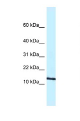 CCL11 / Eotaxin antibody LS-C145582 Western blot of Mouse Spleen lysate. Antibody concentration 1 ug/ml.