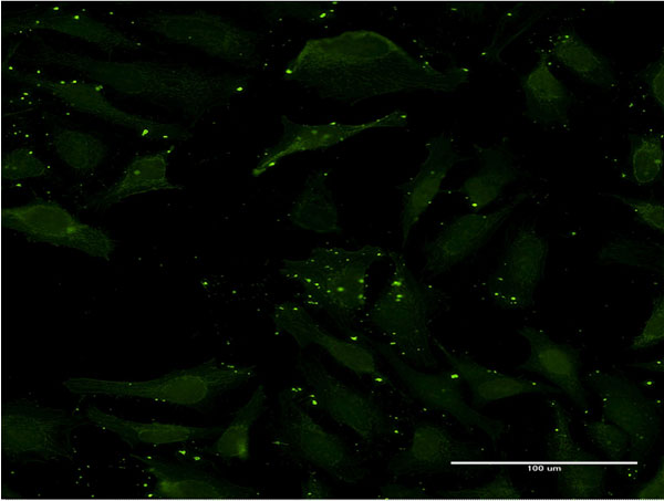 Immunofluorescence of monoclonal antibody to CCL17 on HeLa cell . [antibody concentration 10 ug/ml]