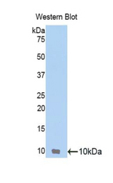 Western blot of recombinant CCL17 / TARC.
