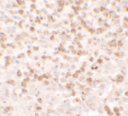 Immunohistochemistry of CCL17 in spleen tissue with CCL17 antibody at 5 ug/ml.