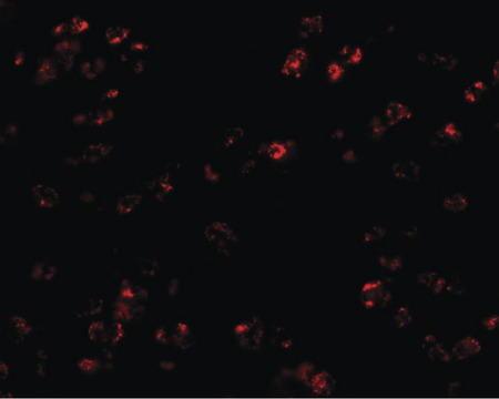 Immunofluorescence of CCL17 in human spleen tissue with CCL17 antibody at 20 ug/ml.
