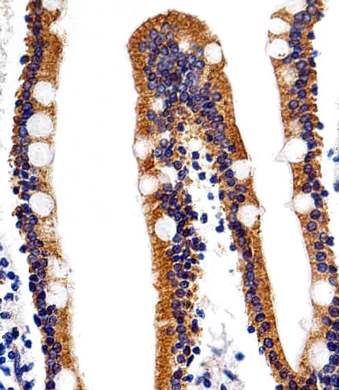 Immunohistochemical of paraffin-embedded H.small intestine section using ACVRL1 Antibody. Antibody was diluted at 1:25 dilution. A peroxidase-conjugated goat anti-rabbit IgG at 1:400 dilution was used as the secondary antibody, followed by DAB staining.