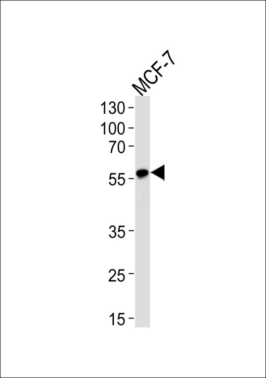 Western blot of lysate from MCF-7 cell line with ACVRL1 Antibody. Antibody was diluted at 1:1000. A goat anti-rabbit IgG H&L (HRP) at 1:5000 dilution was used as the secondary antibody. Lysate at 35 ug.