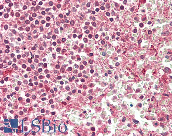 Human Spleen: Formalin-Fixed, Paraffin-Embedded (FFPE)