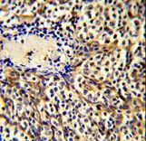 Formalin-fixed and paraffin-embedded human tonsil tissue reacted with CCL3 Antibody , which was peroxidase-conjugated to the secondary antibody, followed by DAB staining. This data demonstrates the use of this antibody for immunohistochemistry; clinical relevance has not been evaluated.