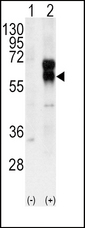 Western blot of ACVRL1 (arrow) using rabbit polyclonal ACVRL1 Antibody. 293 cell lysates (2 ug/lane) either nontransfected (Lane 1) or transiently transfected with the ACVRL1 gene (Lane 2) (Origene Technologies).