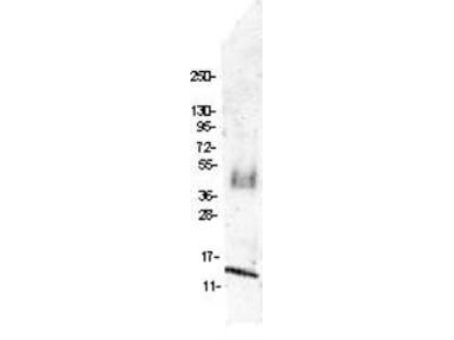 Western blot of protein-A purified Anti-MIP-1 (CCL4) antibody shows detection of recombinant swine MIP-1 (CCL4) raised in yeast. The protein was purified and resolved by SDS-PAGE, then transferred to PVDF membrane. Membrane was blocked with 3% BSA (BSA-30, diluted 1:10), and probed with 4 g/mL primary antibody overnight at 4C. After washing, membrane was probed with IRDye800 Conjugated Goat Anti-Rabbit IgG (p/n 611-132-122) at 1:20000 for 45 min at room temperature.
