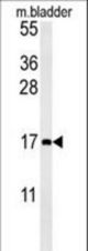 CCL4 Antibody western blot of mouse bladder tissue lysates (15 ug/lane). The CCL4 antibody detected CCL4 protein (arrow).