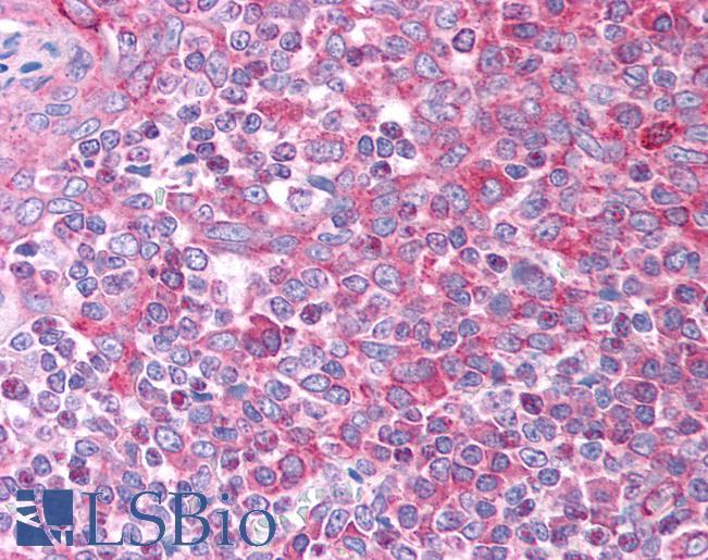 Anti-CCL7 / MCP3 antibody IHC of human tonsil. Immunohistochemistry of formalin-fixed, paraffin-embedded tissue after heat-induced antigen retrieval. Antibody LS-B930 concentration 5 ug/ml.