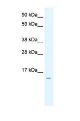CCL7 / MCP3 antibody LS-B930 Western blot of Fetal Intestine lysate. Antibody concentration 1 ug/ml.