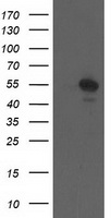 HEK293T cells were transfected with the pCMV6-ENTRY control (Left lane) or pCMV6-ENTRY CCM2 (Right lane) cDNA for 48 hrs and lysed. Equivalent amounts of cell lysates (5 ug per lane) were separated by SDS-PAGE and immunoblotted with anti-CCM2.