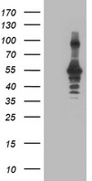 HEK293T cells were transfected with the pCMV6-ENTRY control (Left lane) or pCMV6-ENTRY CCM2 (Right lane) cDNA for 48 hrs and lysed. Equivalent amounts of cell lysates (5 ug per lane) were separated by SDS-PAGE and immunoblotted with anti-CCM2.